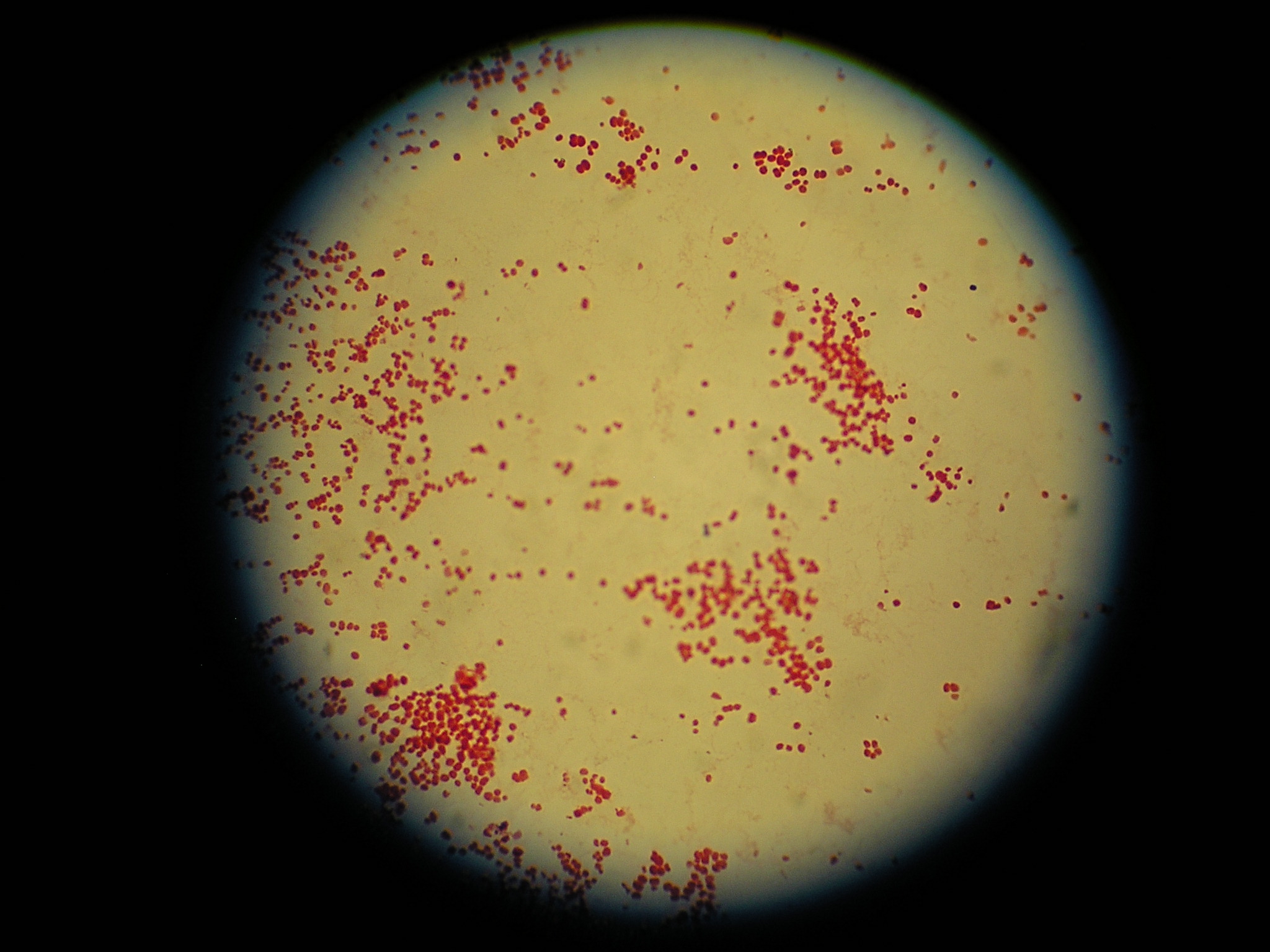 Gram negatieve coccen gezien door de microscoop	